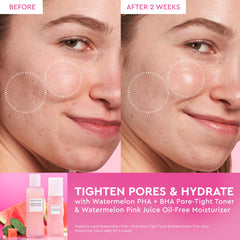 Watermelon Glow Dewy Skin Routine Set