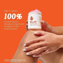 Dry Skin Gel Face & Body Moisturizer -50ml